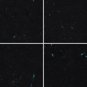 10 Turquoise Flowers Paper Texture Backgrounds Samples Preview - Part 02